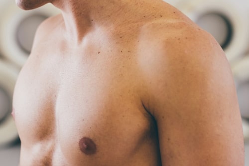 How to Get Rid of Chest Acne Overnight (8 Must-Know Treatment Tips)