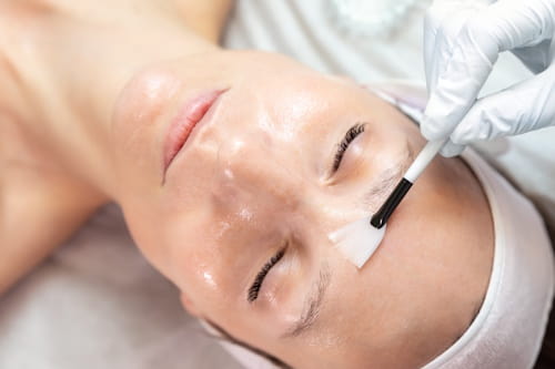 Professional Chemical Peel Prep to Maximize Treatment